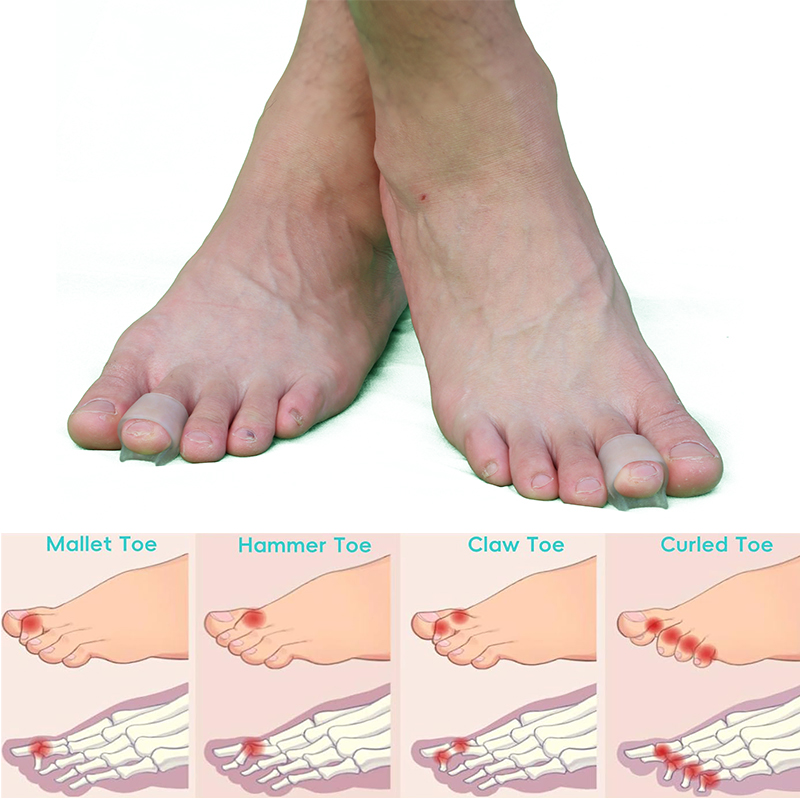 Pexmen 2/4Pcs Gel Hammer Toe C - đánh giá và giá Power Tools Hammer