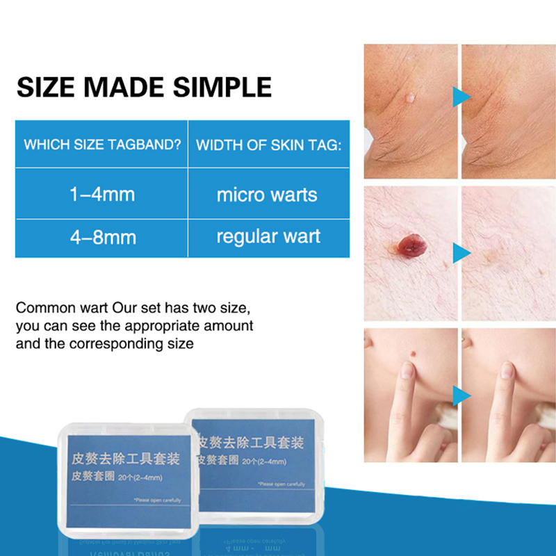20pcs/Box Flesh Nevus Removal  - đánh giá và giá Power Toolbox